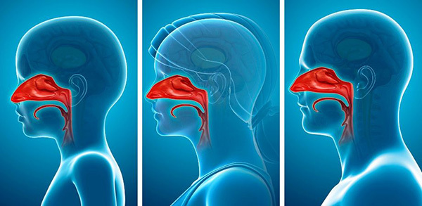 Image of sinuses
