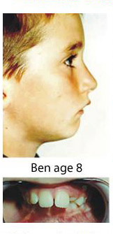 Ben age 8